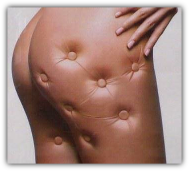 Tratamiento contra la celulitis Canarias